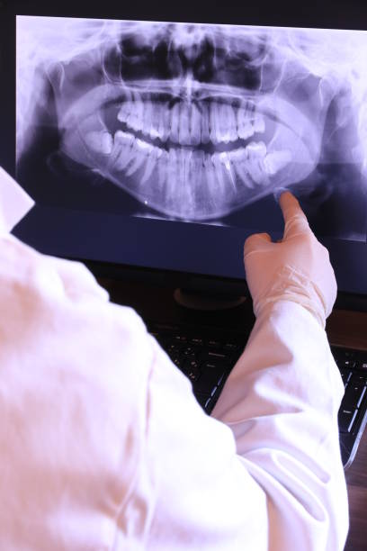 Best Emergency Root Canal Treatment in Savannah, TX