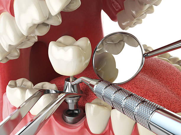 Best Broken or Cracked Tooth Emergency Dentist in Savannah, TX